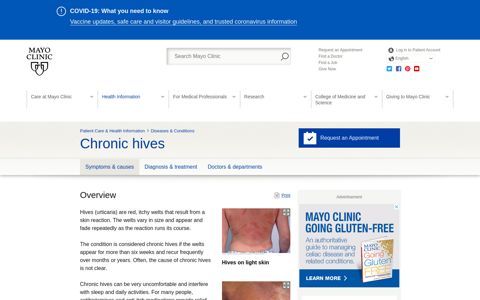 Chronic hives - Symptoms and causes - Mayo Clinic