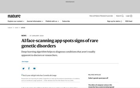 AI face-scanning app spots signs of rare genetic disorders