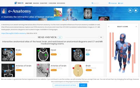 e-Anatomy: radiologic anatomy atlas of the human ... - IMAIOS