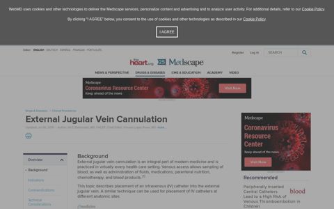 External Jugular Vein Cannulation: Background, Indications ...