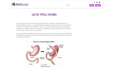 Gastric Bypass Explained - Bandboozled