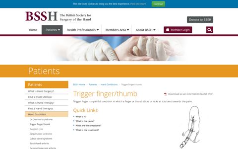 Trigger finger/thumb | The British Society for Surgery of the Hand