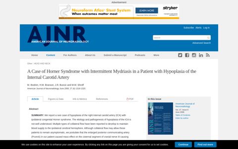 A Case of Horner Syndrome with Intermittent Mydriasis in a ...