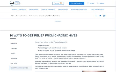 10 ways to get relief from chronic hives