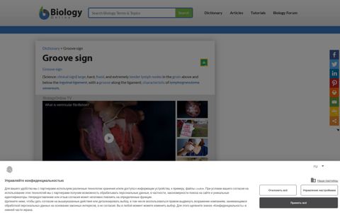 Groove sign Definition and Examples - Biology Online Dictionary